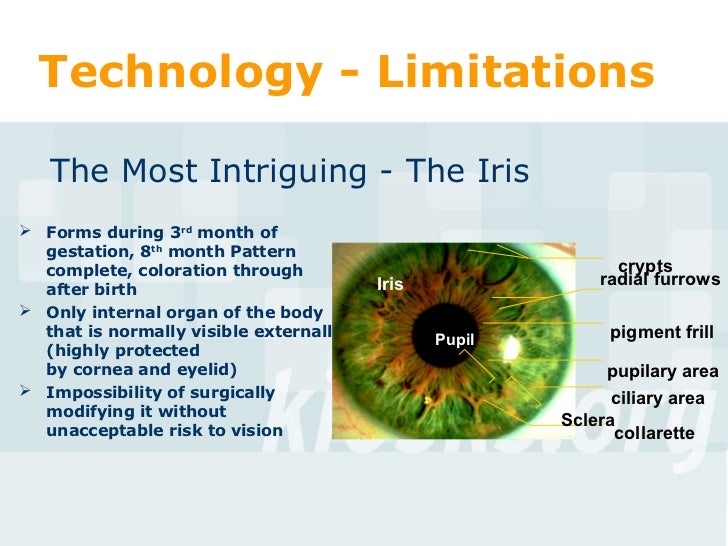 Biometrics Final Visionics