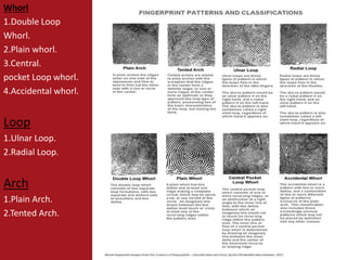 Whorl
1.Double Loop
Whorl.
2.Plain whorl.
3.Central.
pocket Loop whorl.
4.Accidental whorl.
Loop
1.Ulnar Loop.
2.Radial Loop.
Arch
1.Plain Arch.
2.Tented Arch.
 