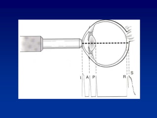 Peripheral Length Biometry | PPTX