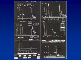 Biometry | PPTX