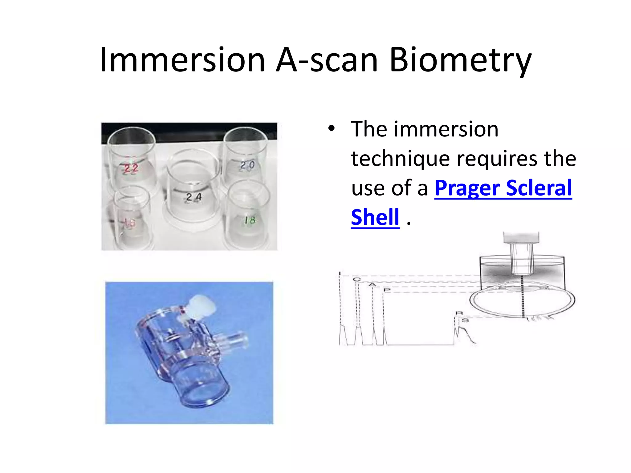 Immersion A-scan Biometry
• The immersion
technique requires the
use of a Prager Scleral
Shell .
 