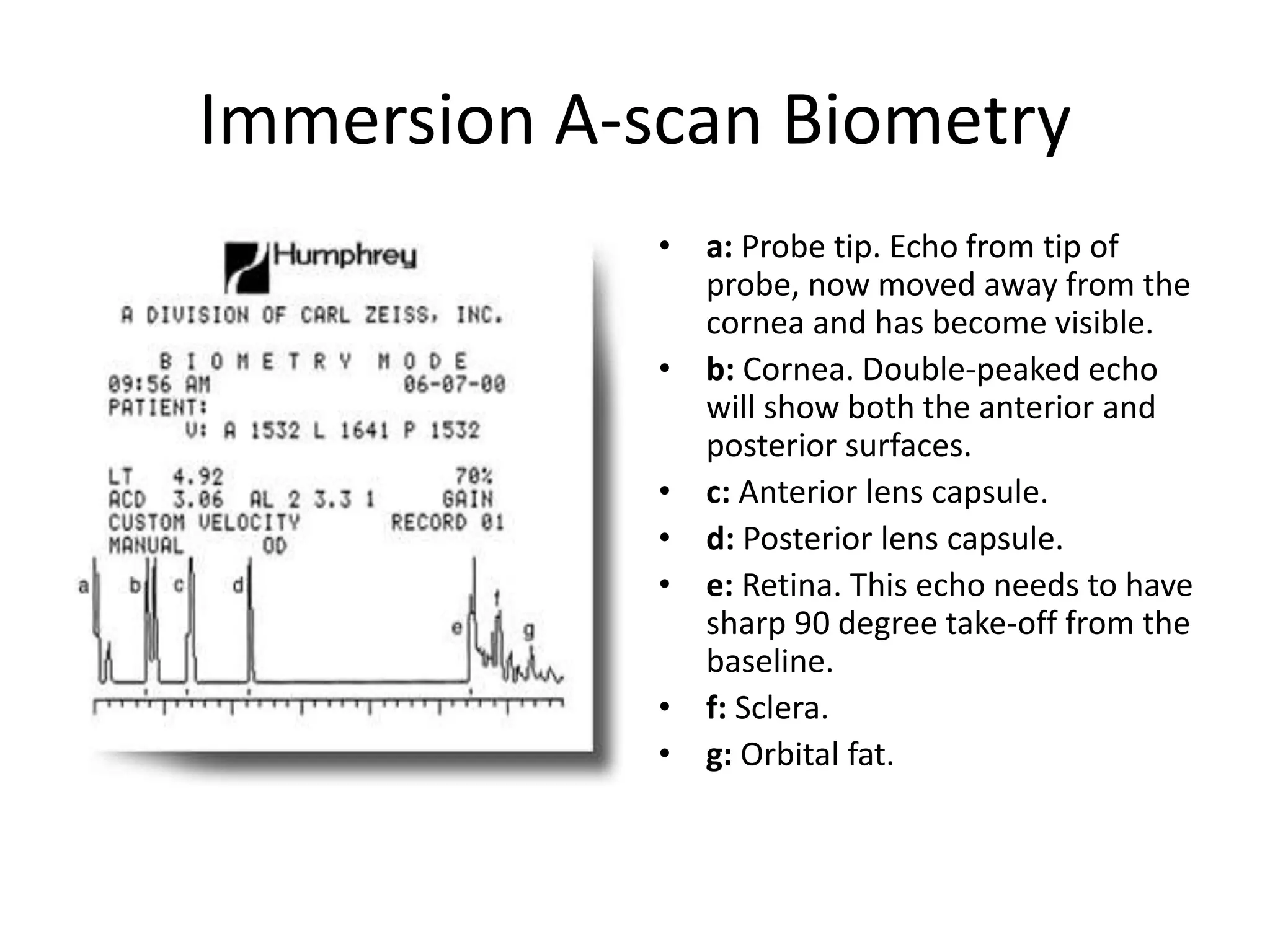 Immersion A-scan Biometry
• . • a: Probe tip. Echo from tip of
probe, now moved away from the
cornea and has become visible.
• b: Cornea. Double-peaked echo
will show both the anterior and
posterior surfaces.
• c: Anterior lens capsule.
• d: Posterior lens capsule.
• e: Retina. This echo needs to have
sharp 90 degree take-off from the
baseline.
• f: Sclera.
• g: Orbital fat.
 