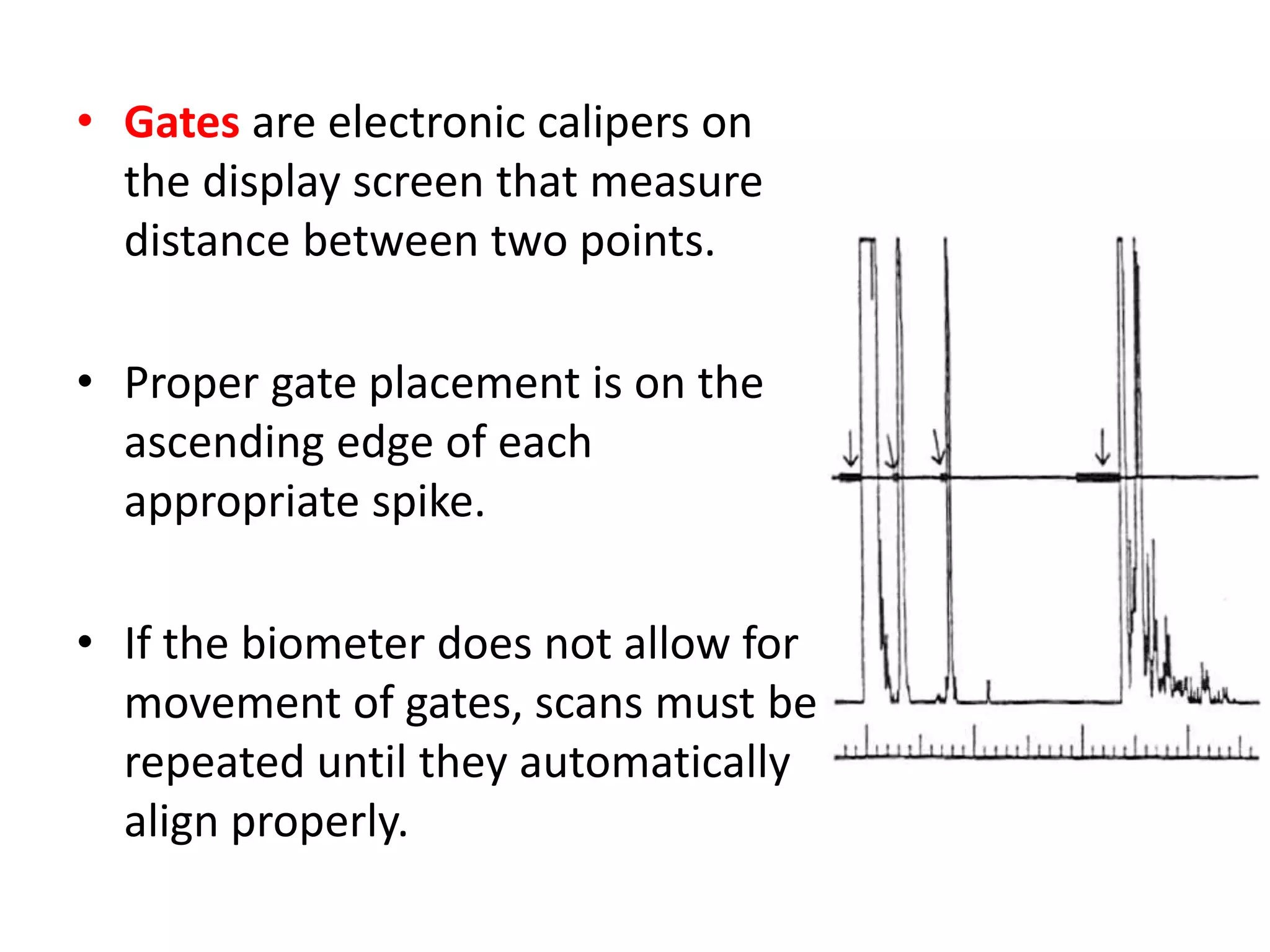 • Gates are electronic calipers on
the display screen that measure
distance between two points.
• Proper gate placement is on the
ascending edge of each
appropriate spike.
• If the biometer does not allow for
movement of gates, scans must be
repeated until they automatically
align properly.
 