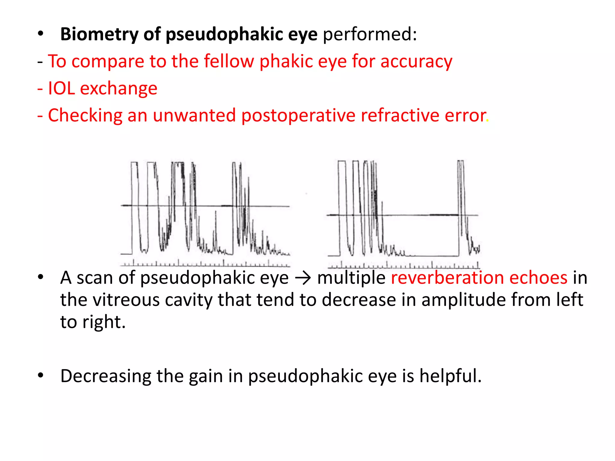 • Biometry of pseudophakic eye performed:
- To compare to the fellow phakic eye for accuracy
- IOL exchange
- Checking an unwanted postoperative refractive error.
• A scan of pseudophakic eye → multiple reverberation echoes in
the vitreous cavity that tend to decrease in amplitude from left
to right.
• Decreasing the gain in pseudophakic eye is helpful.
 
