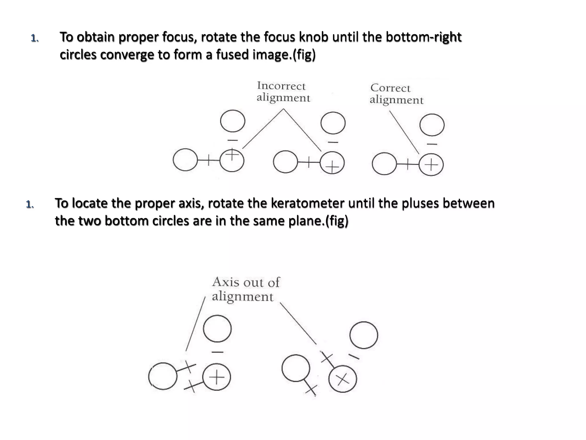 1. To obtain proper focus, rotate the focus knob until the bottom-right
circles converge to form a fused image.(fig)
1. To locate the proper axis, rotate the keratometer until the pluses between
the two bottom circles are in the same plane.(fig)
 
