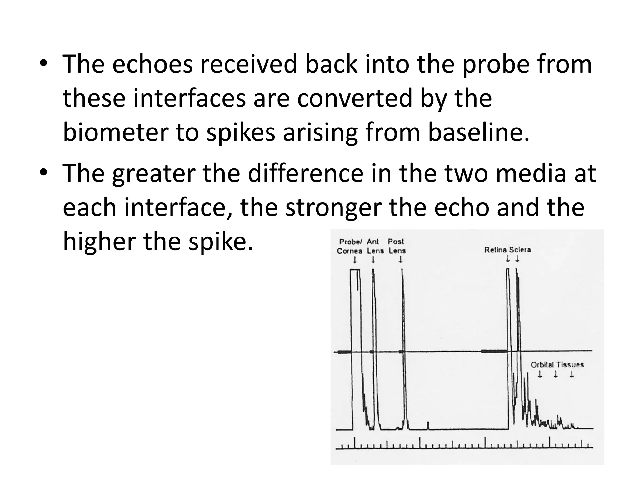 • The echoes received back into the probe from
these interfaces are converted by the
biometer to spikes arising from baseline.
• The greater the difference in the two media at
each interface, the stronger the echo and the
higher the spike.
 
