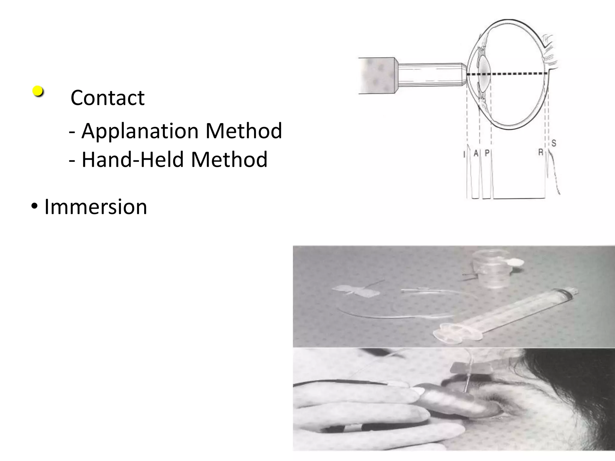 • Contact
- Applanation Method
- Hand-Held Method
• Immersion
 