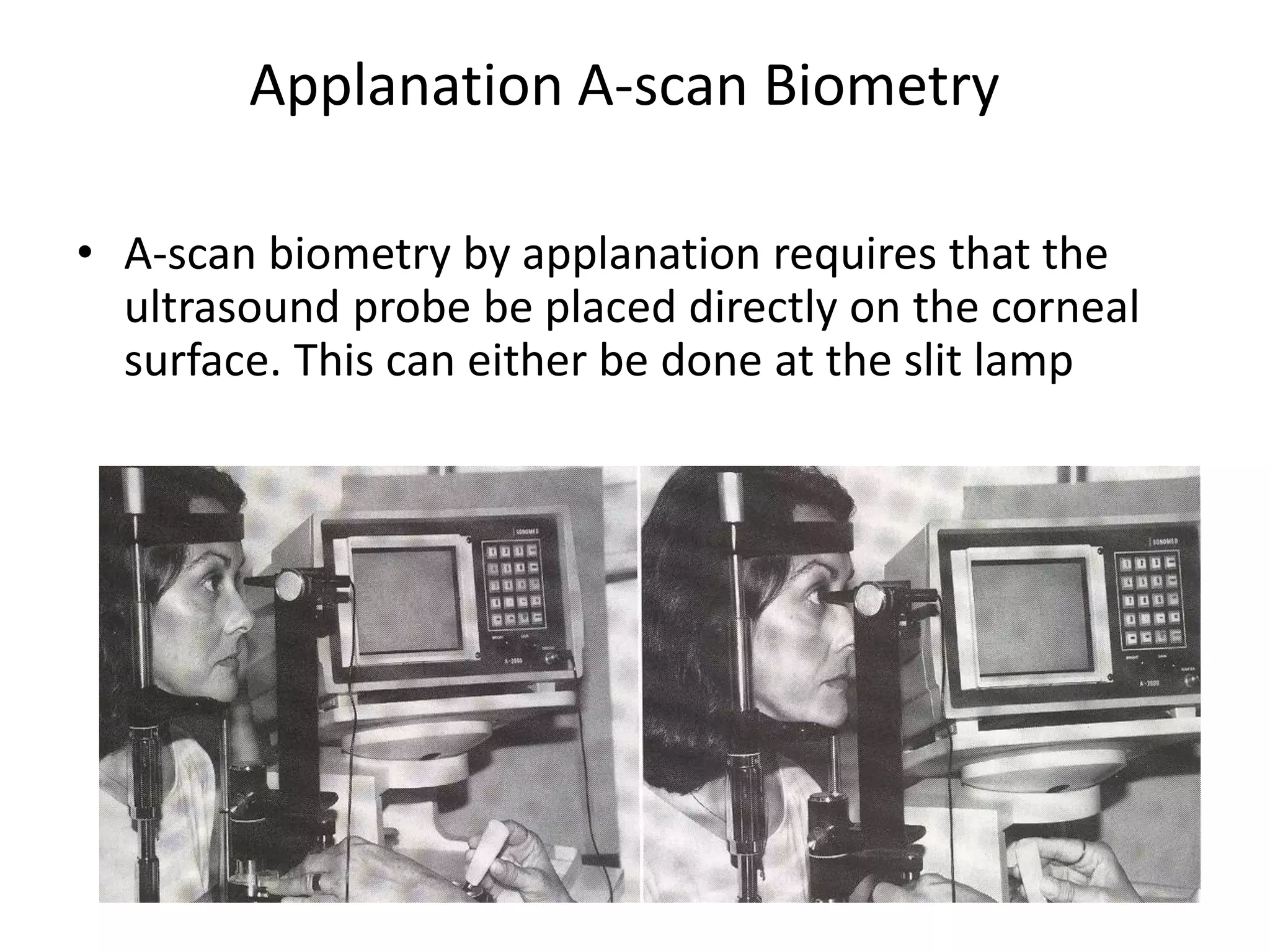 Applanation A-scan Biometry
• A-scan biometry by applanation requires that the
ultrasound probe be placed directly on the corneal
surface. This can either be done at the slit lamp
 