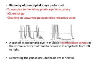 • Biometry of pseudophakic eye performed:
- To compare to the fellow phakic eye for accuracy
- IOL exchange
- Checking an unwanted postoperative refractive error.
• A scan of pseudophakic eye → multiple reverberation echoes in
the vitreous cavity that tend to decrease in amplitude from left
to right.
• Decreasing the gain in pseudophakic eye is helpful.
 