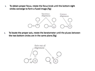 1. To obtain proper focus, rotate the focus knob until the bottom-right
circles converge to form a fused image.(fig)
1. To locate the proper axis, rotate the keratometer until the pluses between
the two bottom circles are in the same plane.(fig)
 
