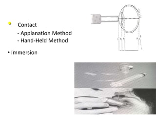 • Contact
- Applanation Method
- Hand-Held Method
• Immersion
 