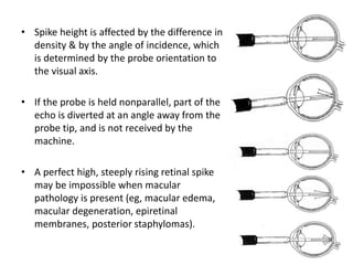• Spike height is affected by the difference in
density & by the angle of incidence, which
is determined by the probe orie...