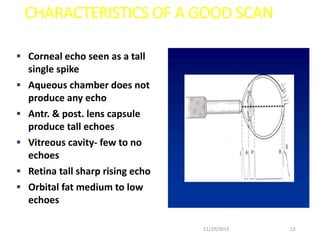  Corneal echo seen as a tall
single spike
 Aqueous chamber does not
produce any echo
 Antr. & post. lens capsule
produce tall echoes
 Vitreous cavity- few to no
echoes
 Retina tall sharp rising echo
 Orbital fat medium to low
echoes
CHARACTERISTICS OF A GOOD SCAN
11/29/2019 13
 
