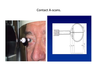 Contact A-scans.
 