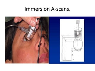 Immersion A-scans.
 