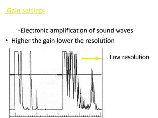 Gain settings
-Electronic amplification of sound waves
• Higher the gain lower the resolution
Low resolution
 