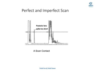 Perfect and Imperfect Scan
A Scan Contact
 