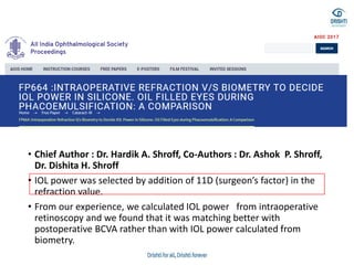 • Chief Author : Dr. Hardik A. Shroff, Co-Authors : Dr. Ashok P. Shroff,
Dr. Dishita H. Shroff
• IOL power was selected by addition of 11D (surgeon’s factor) in the
refraction value.
• From our experience, we calculated IOL power from intraoperative
retinoscopy and we found that it was matching better with
postoperative BCVA rather than with IOL power calculated from
biometry.
 