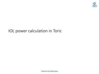 IOL power calculation in Toric
 