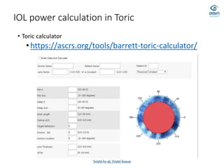 IOL power calculation in Toric
• Toric calculator
•https://ascrs.org/tools/barrett-toric-calculator/
 