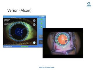 Verion (Alcon)
 