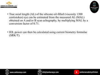 • True axial length (AL) of the silicone oil-filled (viscosity 1300
centistokes) eye can be estimated from the measured AL (MAL)
obtained on A and/or B scan echography, by multiplying MAL by a
conversion factor of 0.71.
• IOL power can then be calculated using current biometry formulae
(SRK/T).
 