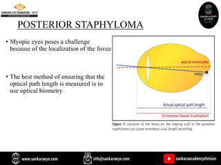 POSTERIOR STAPHYLOMA
• Myopic eyes poses a challenge
because of the localization of the fovea
• The best method of ensuring that the
optical path length is measured is to
use optical biometry
 