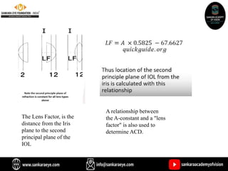 The Lens Factor, is the
distance from the Iris
plane to the second
principal plane of the
IOL
A relationship between
the A-constant and a "lens
factor" is also used to
determine ACD.
 