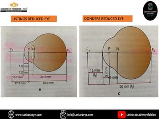 LISTINGS REDUCED EYE DONDERS REDUCED EYE
 