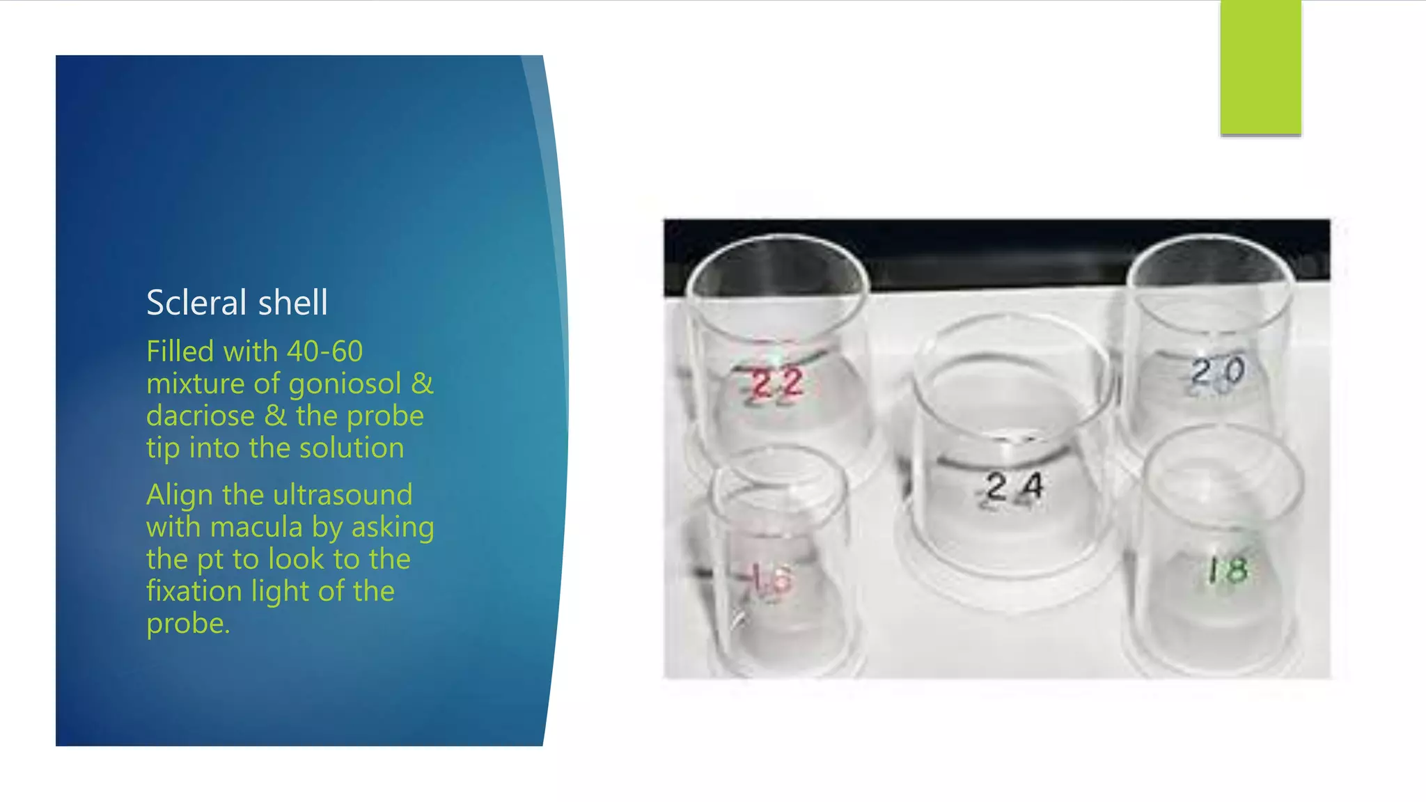 Scleral shell
Filled with 40-60
mixture of goniosol &
dacriose & the probe
tip into the solution
Align the ultrasound
with macula by asking
the pt to look to the
fixation light of the
probe.
 