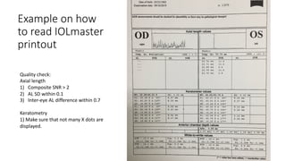 Example on how
to read IOLmaster
printout
Quality check:
Axial length
1) Composite SNR > 2
2) AL SD within 0.1
3) Inter-eye AL difference within 0.7
Keratometry
1) Make sure that not many X dots are
displayed.
 