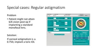 Special cases: Regular astigmatism
Problem
• Patient might not attain
6/6 vision post op if
implanting a standard
monofocal lens.
Solution:
If corneal astigmatism is
0.75D, implant a toric IOL
 