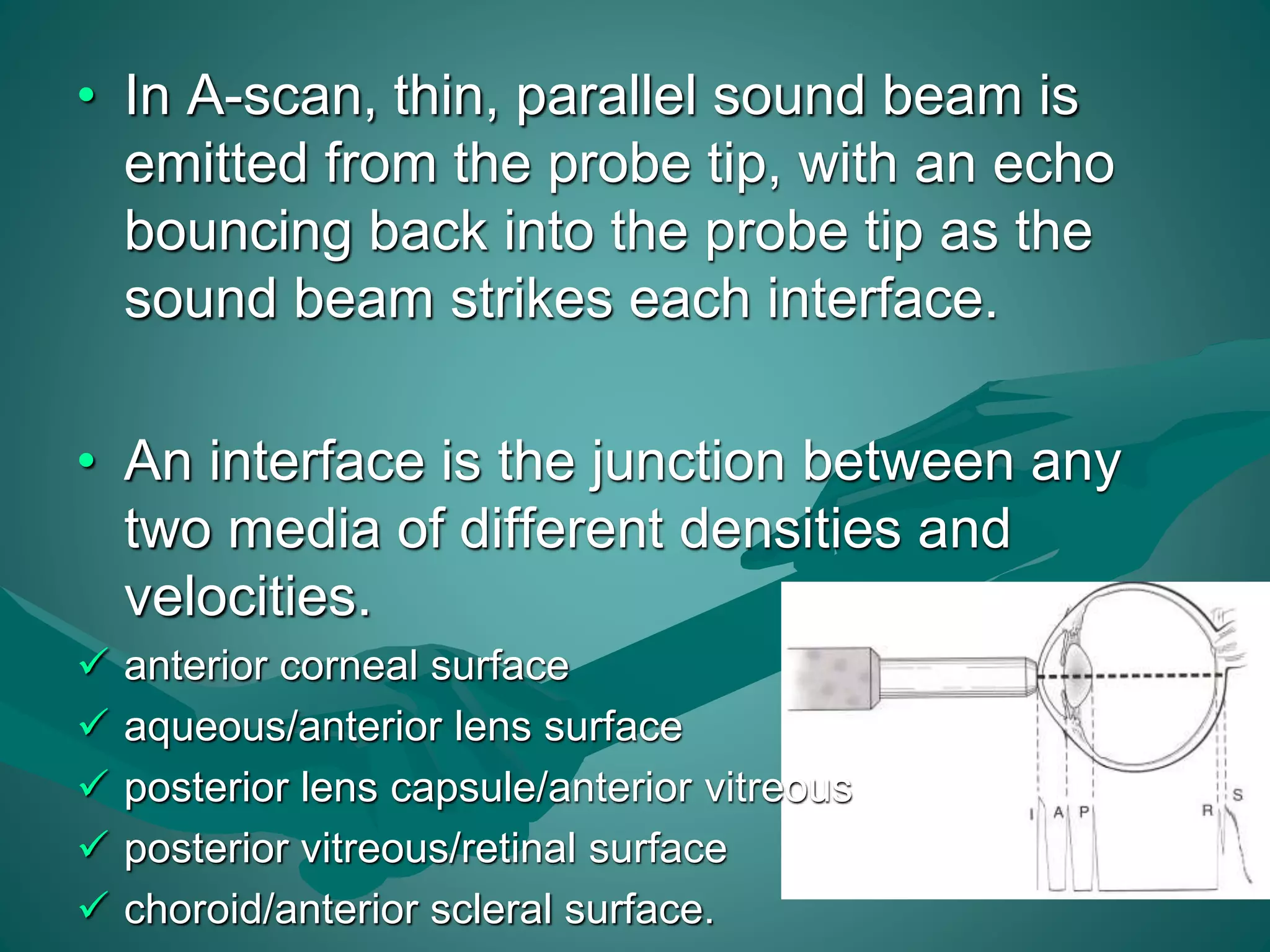 • In A-scan, thin, parallel sound beam is 
emitted from the probe tip, with an echo 
bouncing back into the probe tip as the 
sound beam strikes each interface. 
• An interface is the junction between any 
two media of different densities and 
velocities. 
 anterior corneal surface 
 aqueous/anterior lens surface 
 posterior lens capsule/anterior vitreous 
 posterior vitreous/retinal surface 
 choroid/anterior scleral surface. 
 
