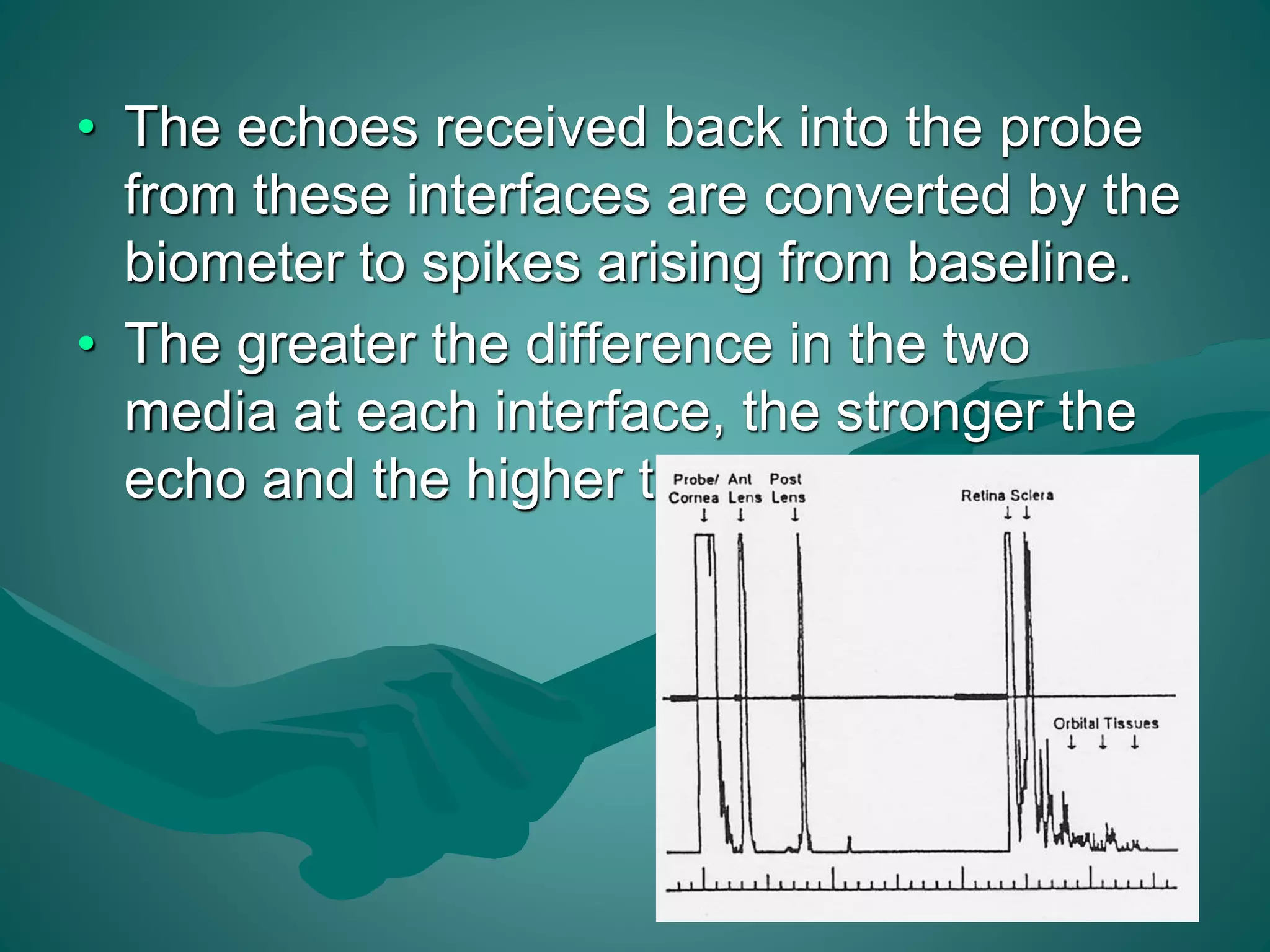• The echoes received back into the probe 
from these interfaces are converted by the 
biometer to spikes arising from baseline. 
• The greater the difference in the two 
media at each interface, the stronger the 
echo and the higher the spike. 
 