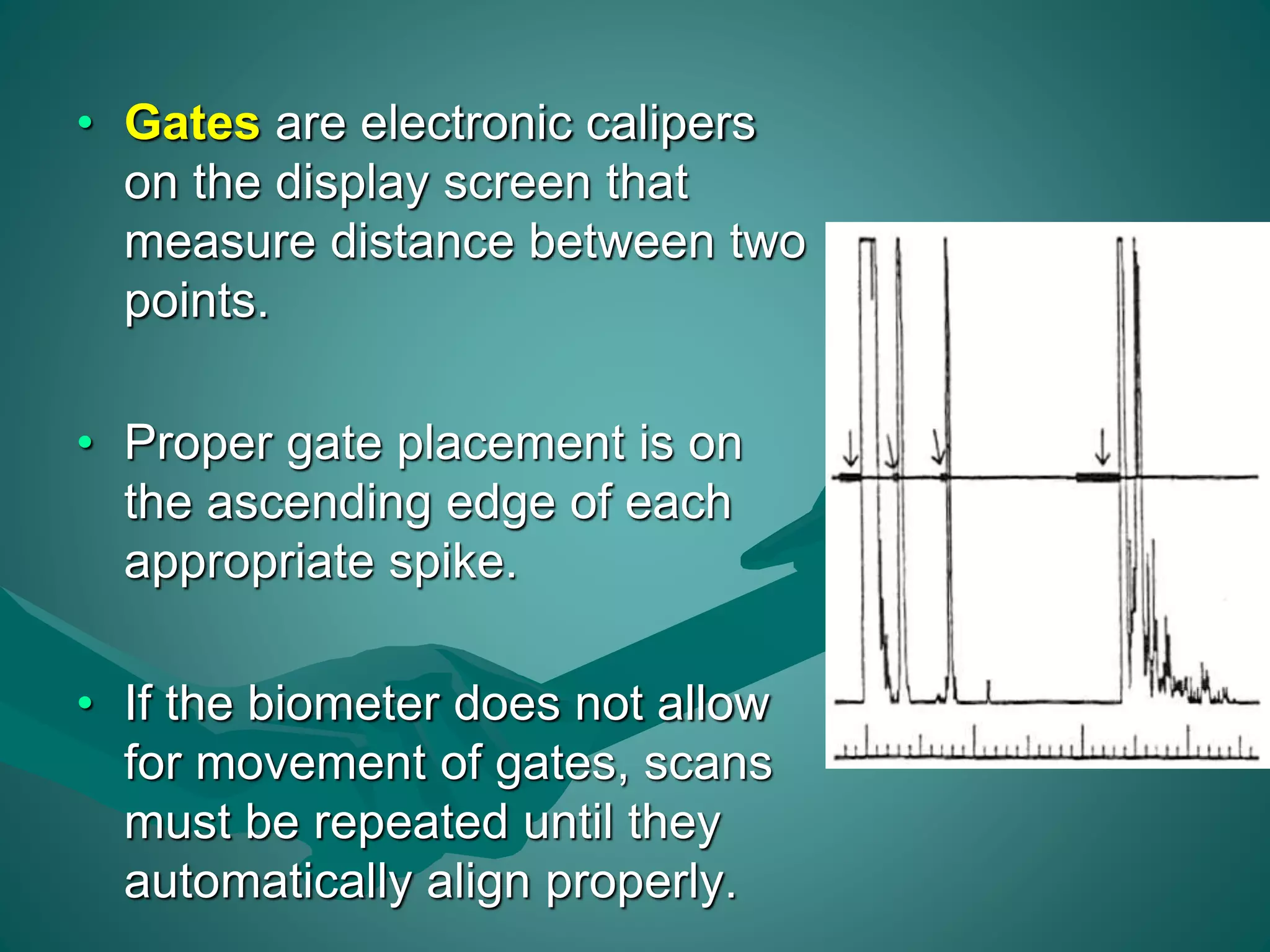 • Gates are electronic calipers 
on the display screen that 
measure distance between two 
points. 
• Proper gate placement is on 
the ascending edge of each 
appropriate spike. 
• If the biometer does not allow 
for movement of gates, scans 
must be repeated until they 
automatically align properly. 
 