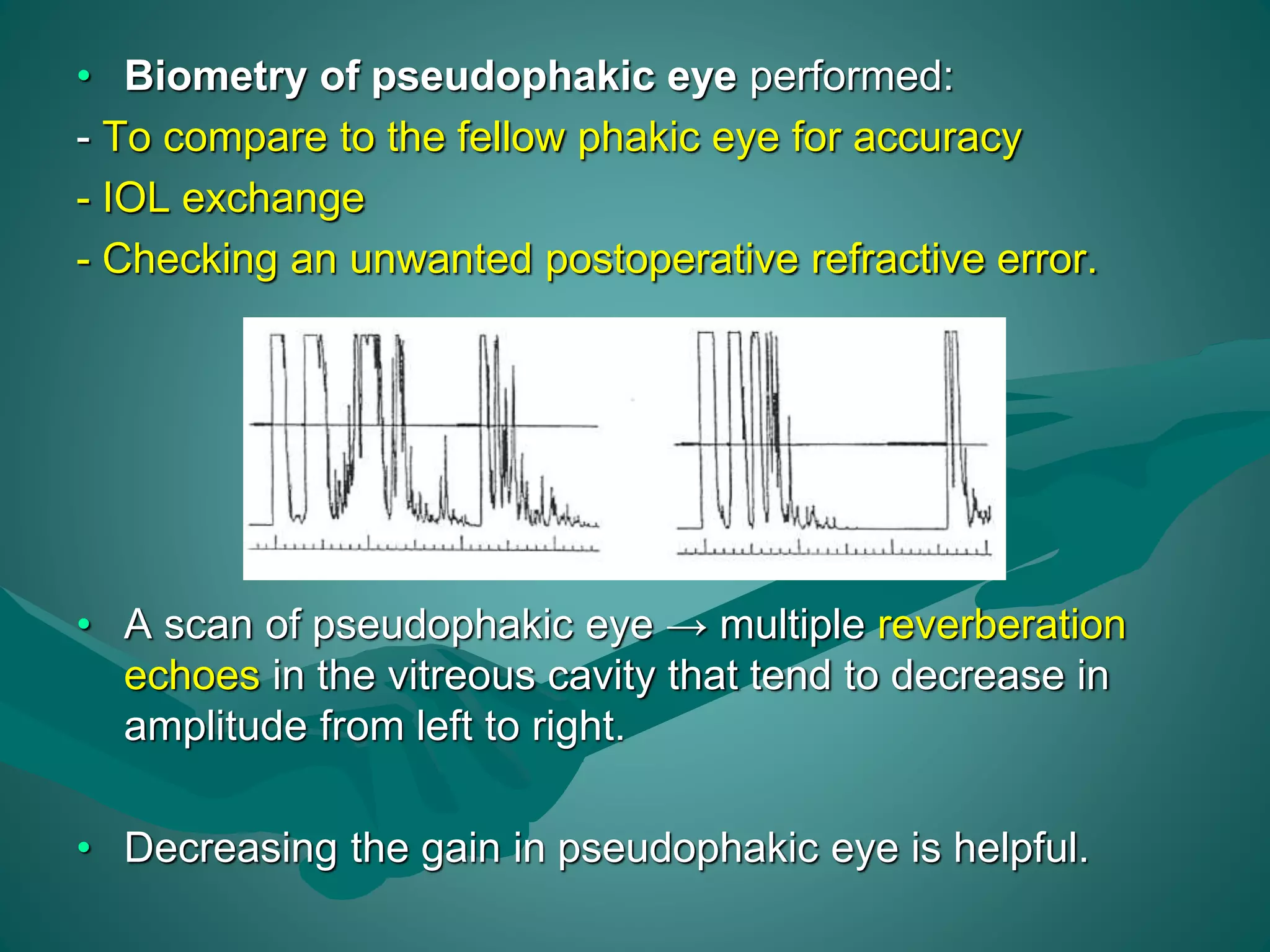 • Biometry of pseudophakic eye performed: 
- To compare to the fellow phakic eye for accuracy 
- IOL exchange 
- Checking an unwanted postoperative refractive error. 
• A scan of pseudophakic eye → multiple reverberation 
echoes in the vitreous cavity that tend to decrease in 
amplitude from left to right. 
• Decreasing the gain in pseudophakic eye is helpful. 
 