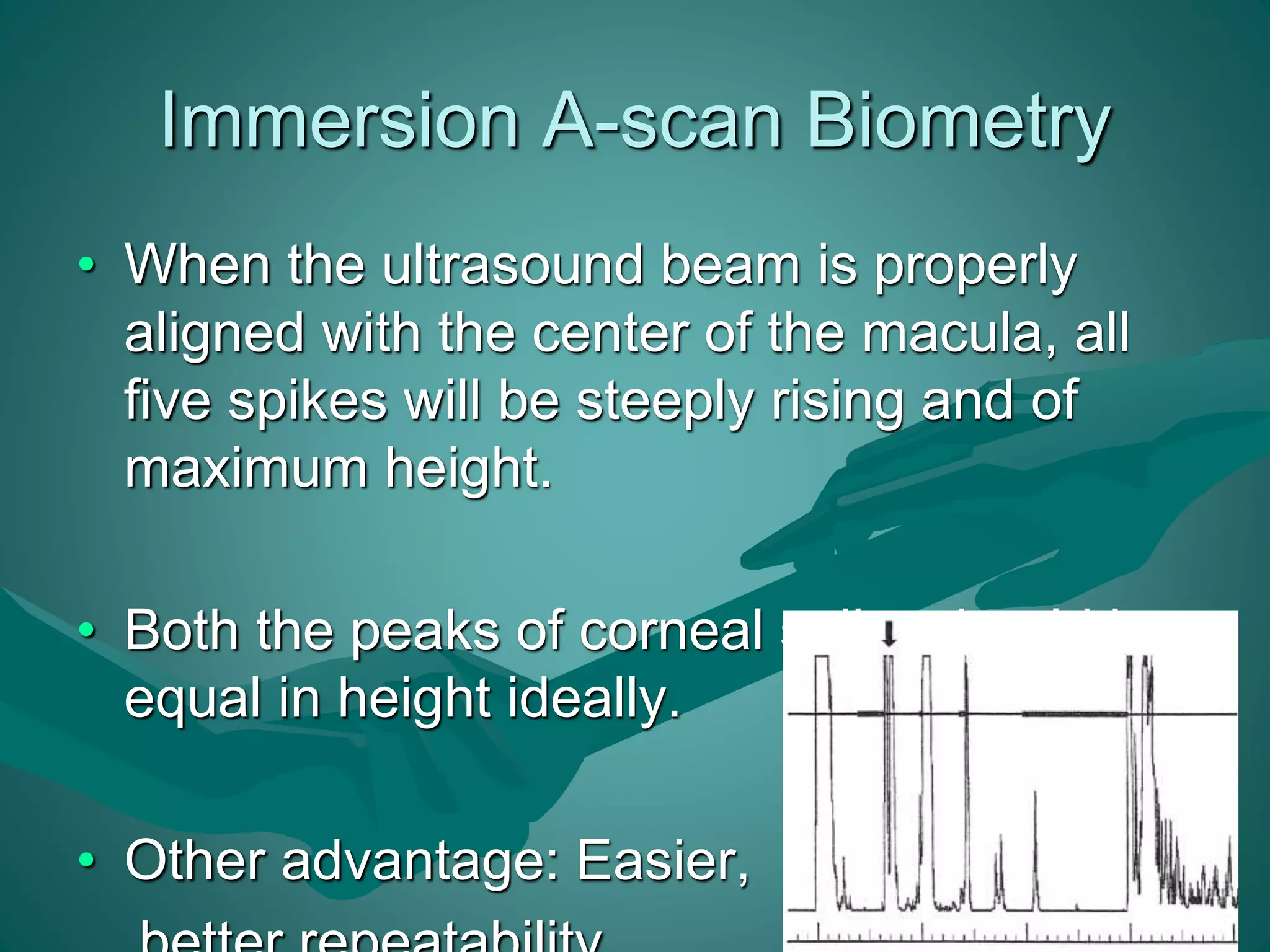 Immersion A-scan Biometry 
• When the ultrasound beam is properly 
aligned with the center of the macula, all 
five spikes will be steeply rising and of 
maximum height. 
• Both the peaks of corneal spike should be 
equal in height ideally. 
• Other advantage: Easier, 
better repeatability. 
 