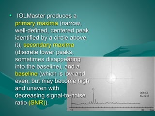 • IOLMaster produces a 
primary maxima (narrow, 
well-defined, centered peak 
identified by a circle above 
it), secondary maxima 
(discrete lower peaks, 
sometimes disappearing 
into the baseline), and a 
baseline (which is low and 
even, but may become high 
and uneven with 
decreasing signal-to-noise 
ratio (SNR)). 
 