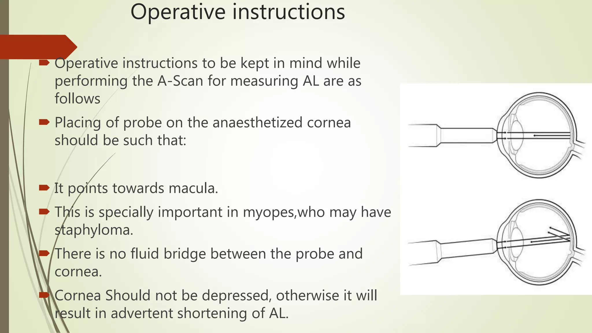 Operative instructions
 Operative instructions to be kept in mind while
performing the A-Scan for measuring AL are as
follows
 Placing of probe on the anaesthetized cornea
should be such that:
 It points towards macula.
 This is specially important in myopes,who may have
staphyloma.
 There is no fluid bridge between the probe and
cornea.
 Cornea Should not be depressed, otherwise it will
result in advertent shortening of AL.
 