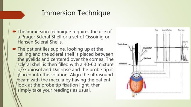 Biometry Procedure Ppt Free Download