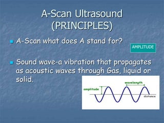 A-Scan Ultrasound
(PRINCIPLES)
 A-Scan what does A stand for?
 Sound wave-a vibration that propagates
as acoustic waves through Gas, liquid or
solid.
AMPLITUDE
 