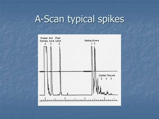 A-Scan typical spikes
 