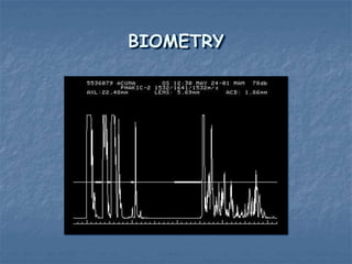 BIOMETRY
 