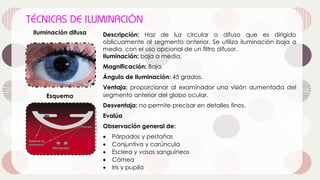 Iluminación difusa Descripción: Haz de luz circular o difuso que es dirigido
oblicuamente al segmento anterior. Se utiliza iluminación baja a
media, con el uso opcional de un filtro difusor.
Iluminación: baja a media.
Magnificación: Baja.
Ángulo de Iluminación: 45 grados.
Ventaja: proporcionar al examinador una visión aumentada del
segmento anterior del globo ocular.
Desventaja: no permite precisar en detalles finos.
Evalúa
Observación general de:
• Párpados y pestañas
• Conjuntiva y carúncula
• Esclera y vasos sanguíneos
• Córnea
• Iris y pupila
Esquema
 