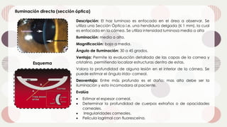 Iluminación directa (sección óptica)
Esquema
Descripción: El haz luminoso es enfocado en el área a observar. Se
utiliza una Sección Óptica i.e. una hendidura delgada (≤ 1 mm), la cual
es enfocada en la córnea. Se utiliza intensidad luminosa media a alta
Iluminación: media a alta.
Magnificación: baja a media.
Ángulo de Iluminación: 30 a 45 grados.
Ventaja: Permite la evaluación detallada de las capas de la cornea y
cristalino, permitiendo localizar estructuras dentro de estas.
Valora la profundidad de alguna lesión en el interior de la córnea. Se
puede estimar el ángulo irido- corneal.
Desventaja: Entre más profundo es el daño: mas alta debe ser la
iluminación y esto incomodara al paciente.
Evalúa
• Estimar el espesor corneal.
• Determinar la profundidad de cuerpos extraños o de opacidades
corneales.
• Irregularidades corneales.
• Película lagrimal con fluoresceína.
 