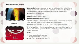Retroiluminación directa
Esquema
Descripción: Se aprovecha la luz que se refleja del iris o retina (luz de
fondo) que incide sobre la zona corneal a observar. Se utiliza un
paralelepípedo, con una intensidad luminosa de media a alta.
Iluminación: media a alta.
Magnificación: media a alta.
Ángulo de Iluminación: 60 grados.
Ventaja: útil para iluminar desde atrás diversas condiciones corneales
o del cristalino, sobre todo aquellas de bajo contraste.
Desventaja: Es más fácil de llevar a cabo con pupilas dilatadas.
Si no es posible, y fuera necesaria una mayor cantidad de luz se
puede ensanchar ligeramente la hendidura, aunque el diámetro
pupilar disminuirá.
Evalúa
• Neovascularización corneal
• Cuerpos extraños en córnea
• Depósitos en lentes de contacto
 