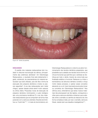 Freitas CMC, Freitas WMC, Freitas RMC
115Rev Dental Press Estét. 2010 jul-set;7(3):104-16
Figura 42 - Sorriso da paciente.
DISCUSSÃO
O padrão dos materiais restauradores tem mu-
dado no decorrer da evolução da ciência, principal-
mente das cerâmicas dentárias6
. Em Odontologia
Restauradora, o resultado final está diretamente li-
gado, sobretudo, às características do material res-
taurador que será utilizado, pois ele dita a forma de
execução dos preparos dentários e todos os pas-
sos seguintes8
. A era das restaurações sem metal
chegou, apesar desses ainda serem muito valiosos
na clínica diária. Propostas novas de execução de
preparos dentários minimizando o custo biológico
são uma promissora tendência! É a vez dos mate-
riais restauradores que se comportam de forma mais
parecida com a estrutura dentária: filosofia biomimé-
tica ou “tooth-like”10,11
. A meta do biomimetismo em
Odontologia Restauradora é o retorno ao pleno fun-
cionamento dos tecidos dentários preparados, que
possibilita que a adesão aos tecidos duros forme um
vínculo funcional que permite que o estresse se dis-
tribua por todo o dente, tirando da coroa toda sua
finalidade estética e funcional. Restaurar ou imitar a
biomecânica da estrutura dentária constitui a força
motriz desse processo, e aplicar esses conceitos
elevando-os a um nível macroestrutural pode inovar
os conceitos em Odontologia Restauradora9
. Nos
últimos anos, entendemos que talvez nossos mate-
riais não precisassem ser tão rígidos, começamos a
olhar para a estrutura dentária e observar que a ade-
são entre o esmalte e a dentina se relaciona de uma
forma complexa e bela; por isso o esmalte, estrutura
friável, resiste bem aos desafios mastigatórios9,10
.
 