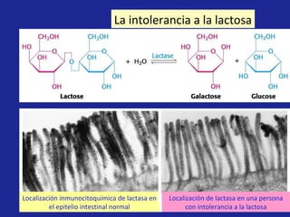 La intolerancia a la lactosa Localización inmunocitoquimica de lactasa en el epitelio intestinal normal Localización de lactasa en una persona con intolerancia a la lactosa 