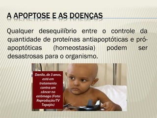 A APOPTOSE E AS DOENÇAS 
Qualquer desequilíbrio entre o controle da quantidade de proteínas antiapoptóticas e pró- apoptóticas (homeostasia) podem ser desastrosas para o organismo.  