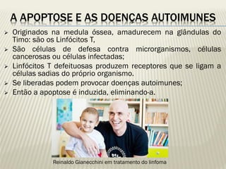 A APOPTOSE E AS DOENÇAS AUTOIMUNES 
Originados na medula óssea, amadurecem na glândulas do Timo: são os Linfócitos T, 
São células de defesa contra microrganismos, células cancerosas ou células infectadas; 
Linfócitos T defeituosas produzem receptores que se ligam a células sadias do próprio organismo. 
Se liberadas podem provocar doenças autoimunes; 
Então a apoptose é induzida, eliminando-a. 
Reinaldo Gianecchini em tratamento do linfoma  